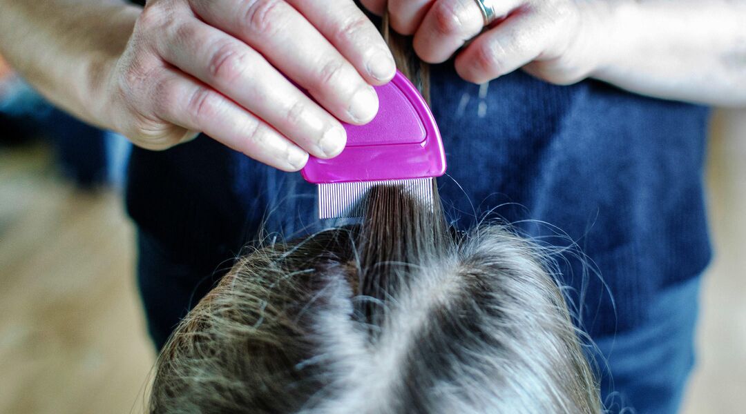 Combing out lice