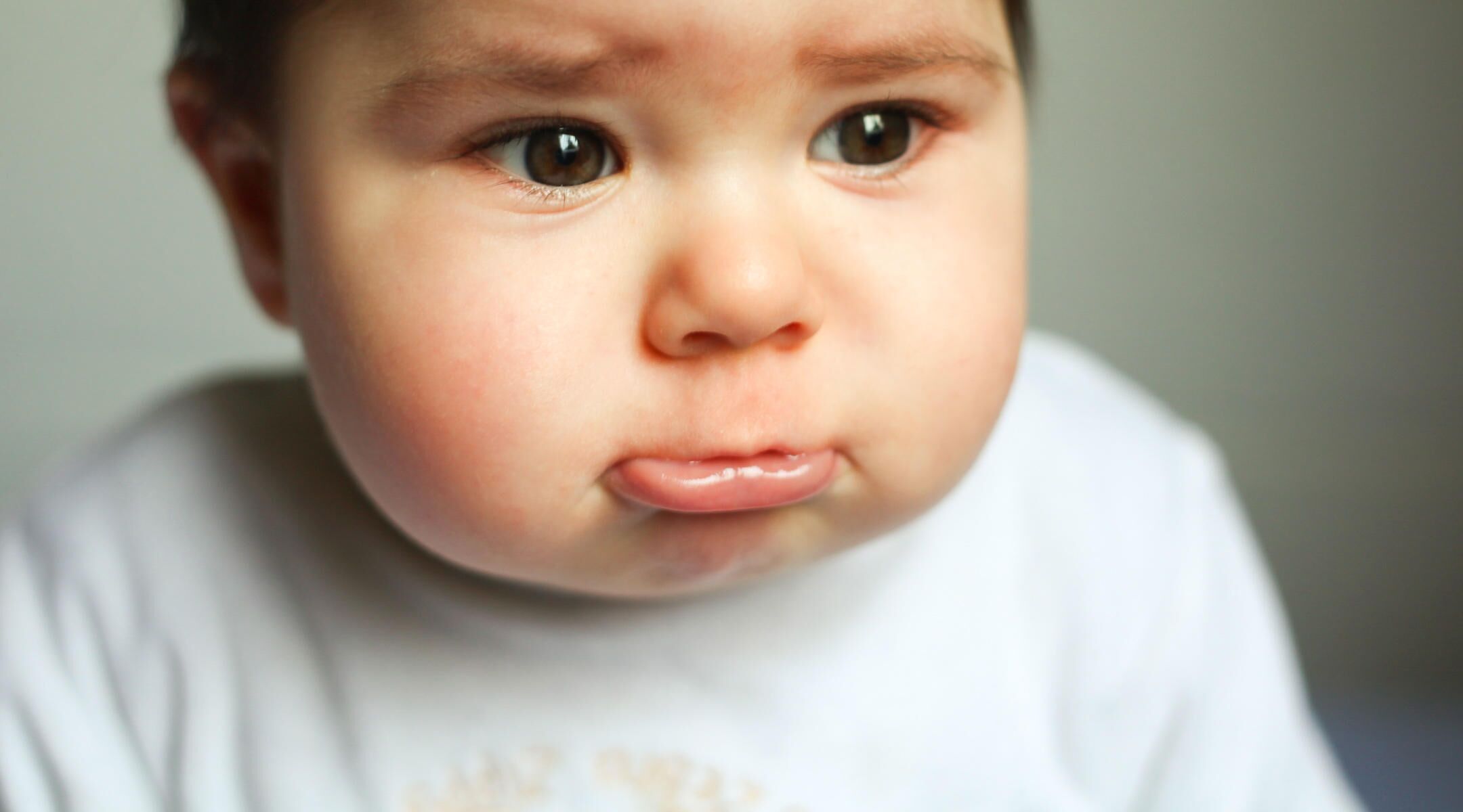 baby born with no ears