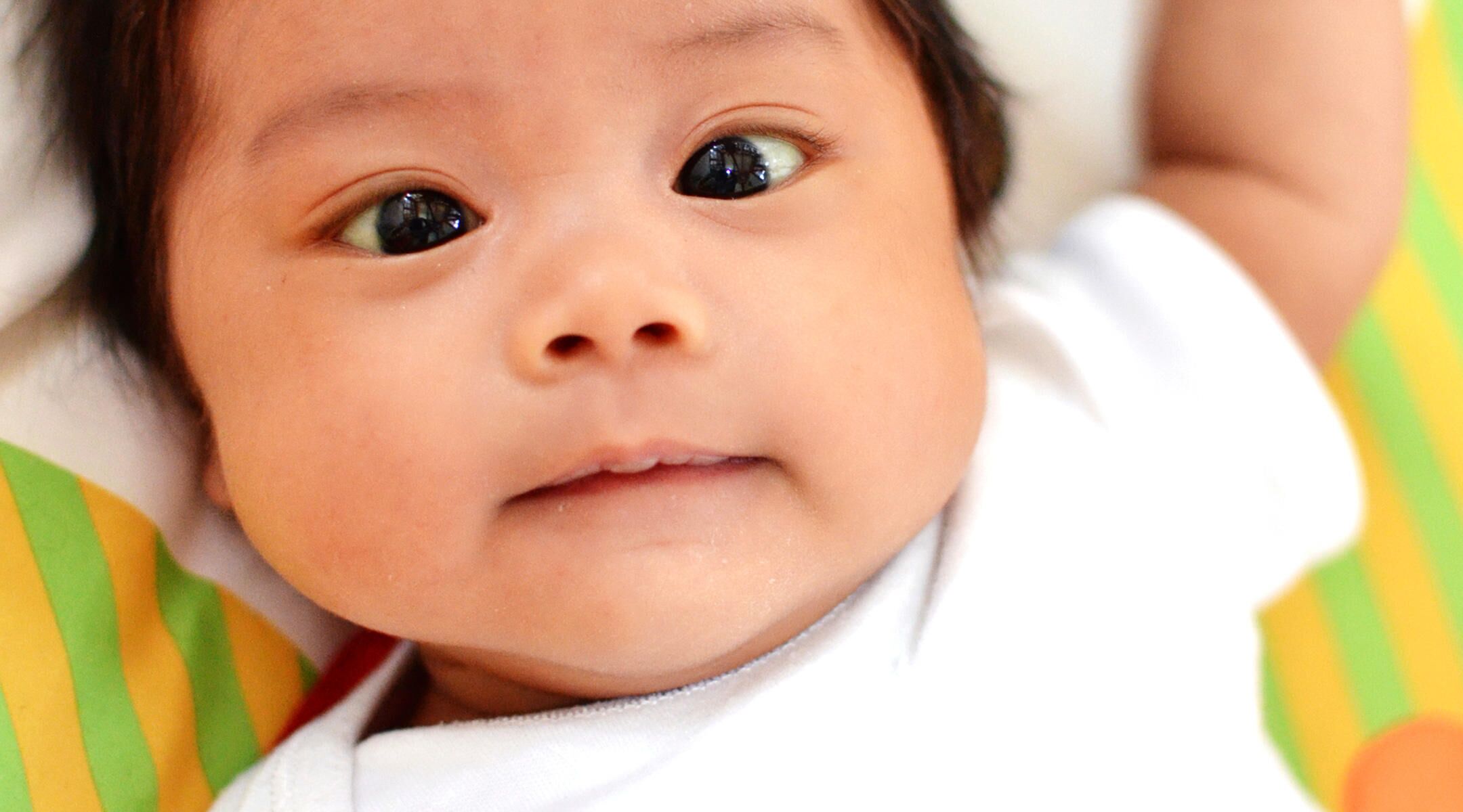 Q&A: Newborn Has Crossed Eyes?