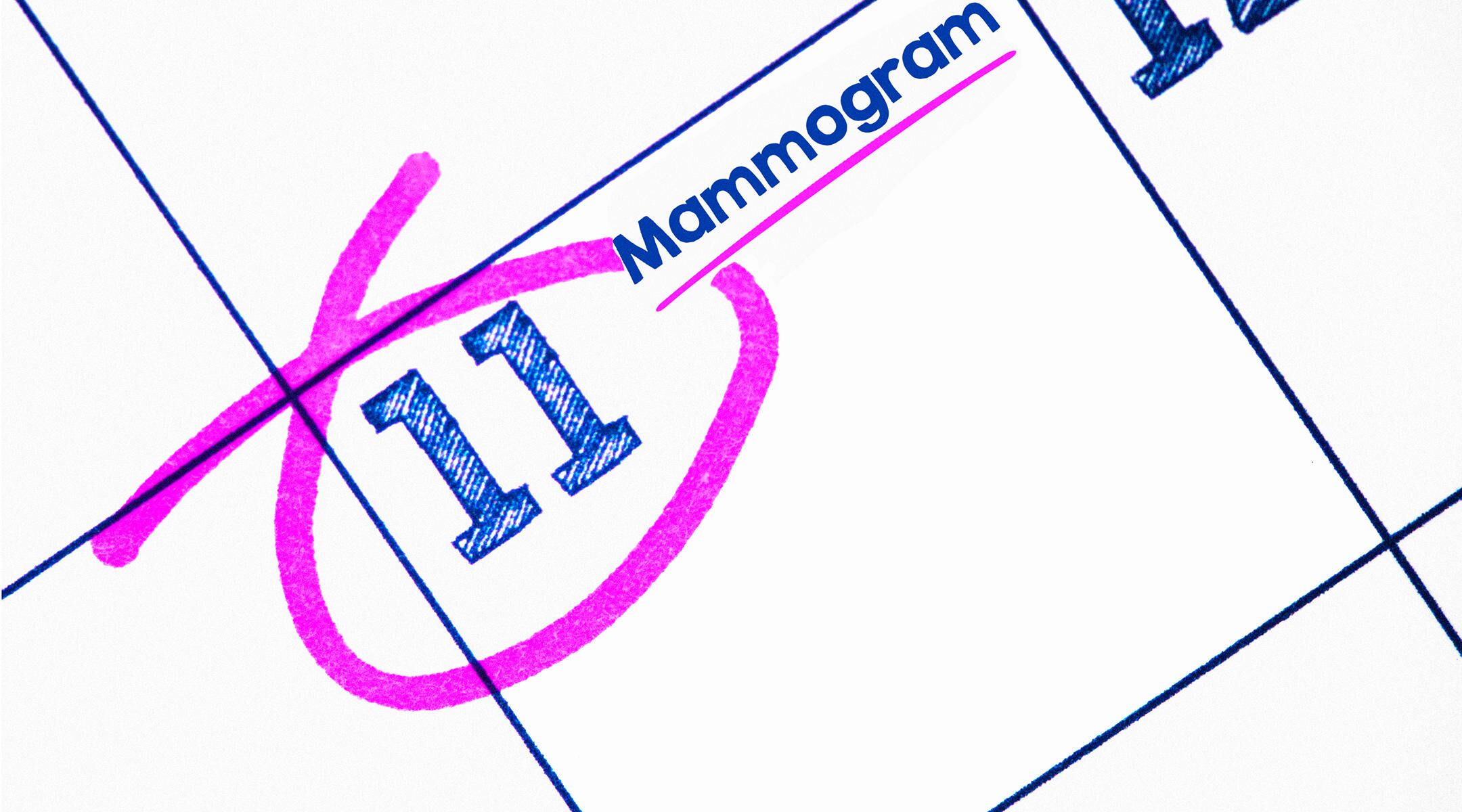 mammogram while breastfeeding