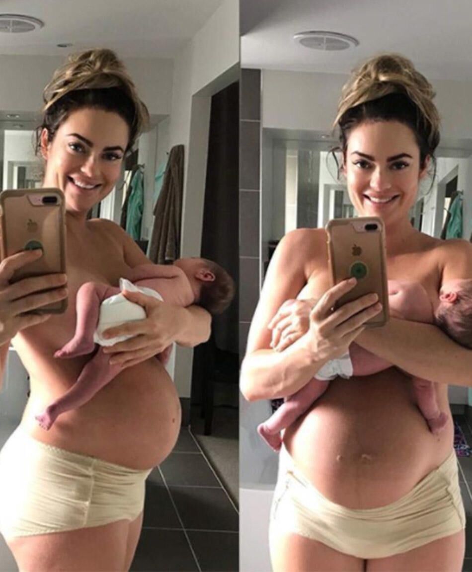 Fitness Expert Emily Skye Shares Postpartum Selfie