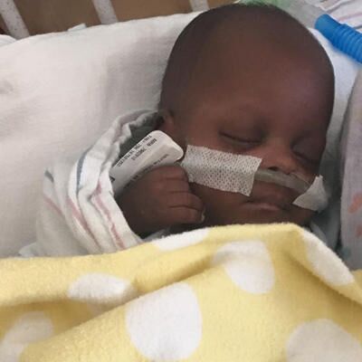 UPDATE: 'Baby Buns' Undergoes Heart Surgery