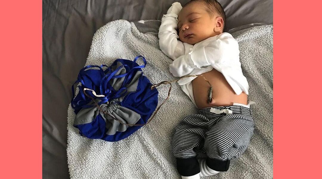 Days-old baby still attached to umbilical cord in a bag
