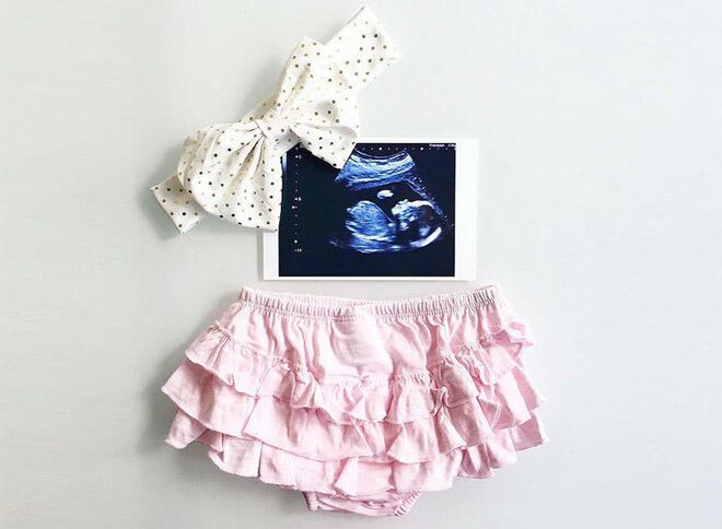 pregnancy-announcement-cute-sonogram-outfit