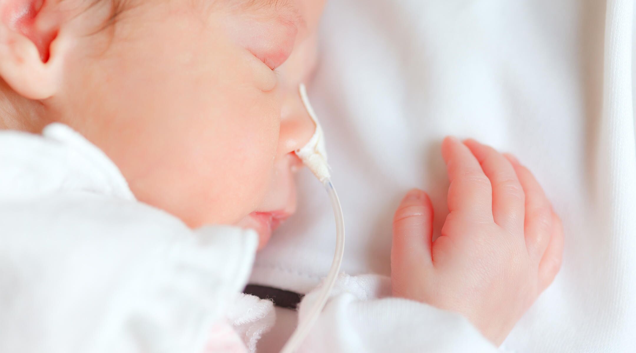 benefits-of-increased-vitamin-d-in-premature-babies