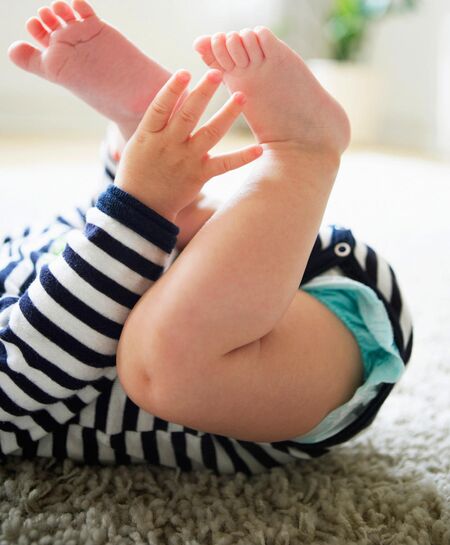 Why does baby have bowed legs?