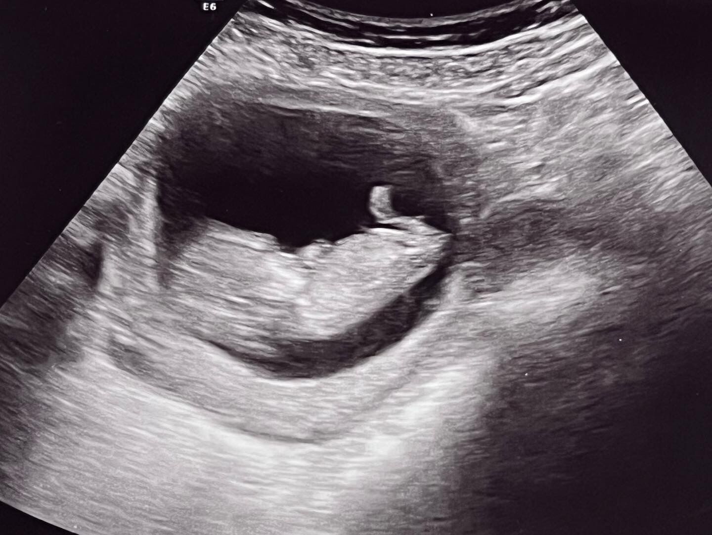 Ashley & Amber’s registry picture 