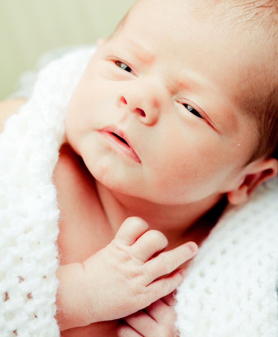 Baby and Newborn Cross Eyed: Causes and Treatment