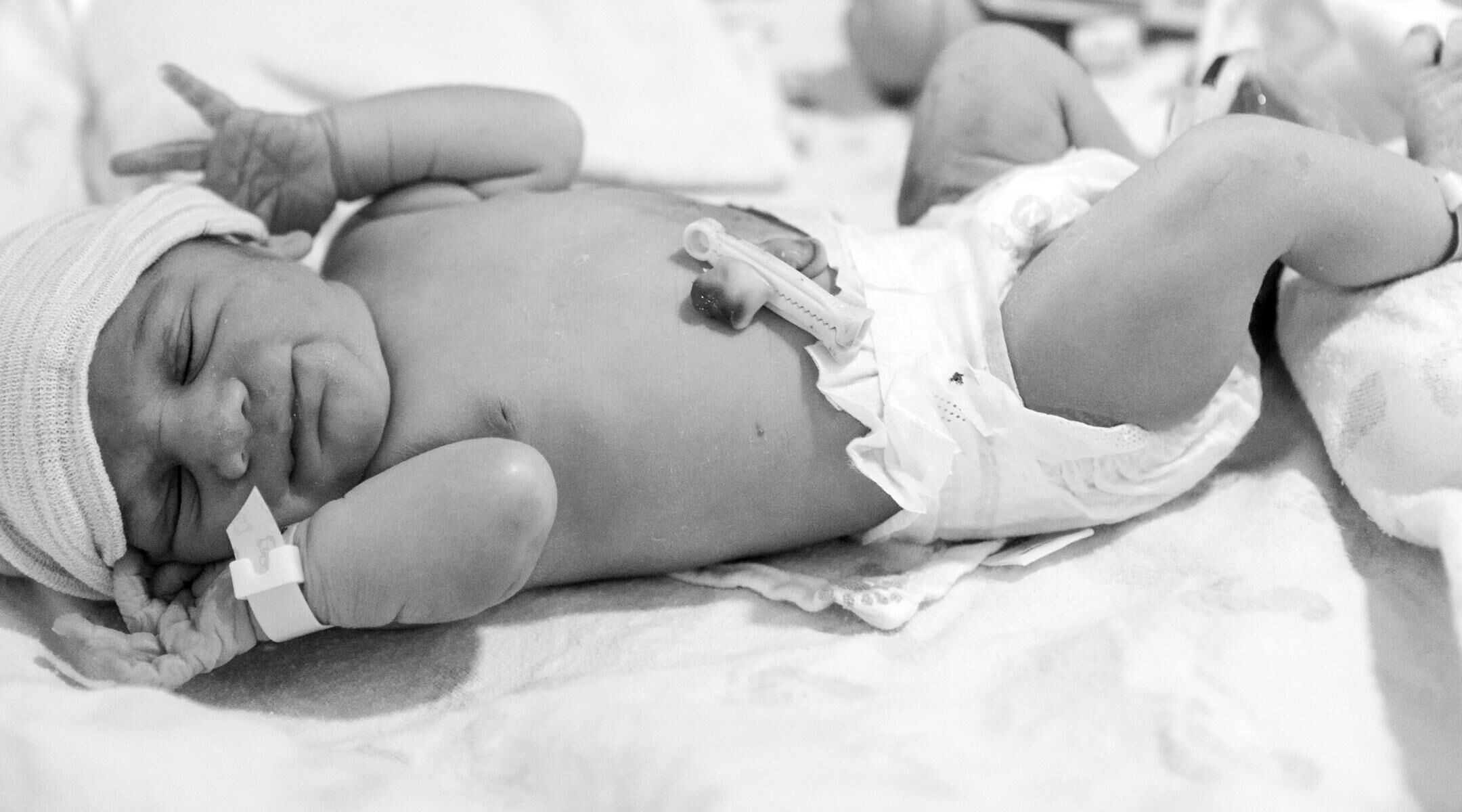 How to Care for Baby's Umbilical Cord