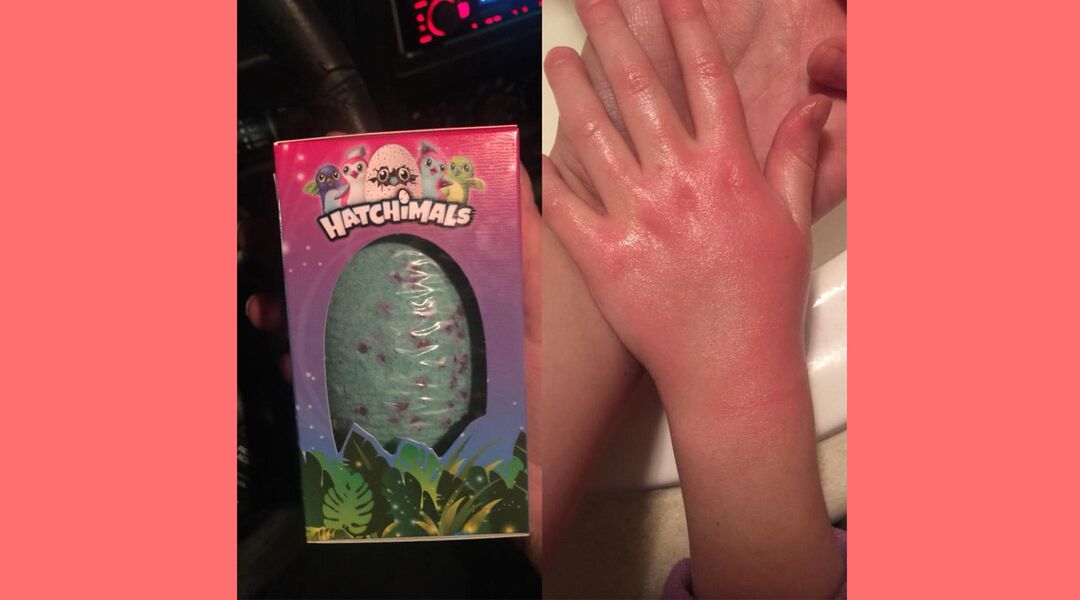 Little girl's red hand next to Hatchimals bath bomb product